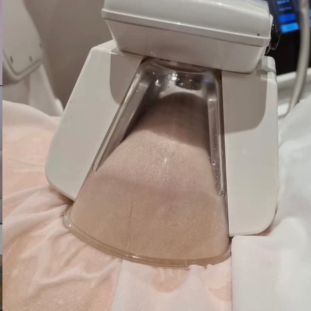 ✨ Cryo Freeze May promo✨ at Nena’s Beauty Glow Bar in North Las Vegas, NV